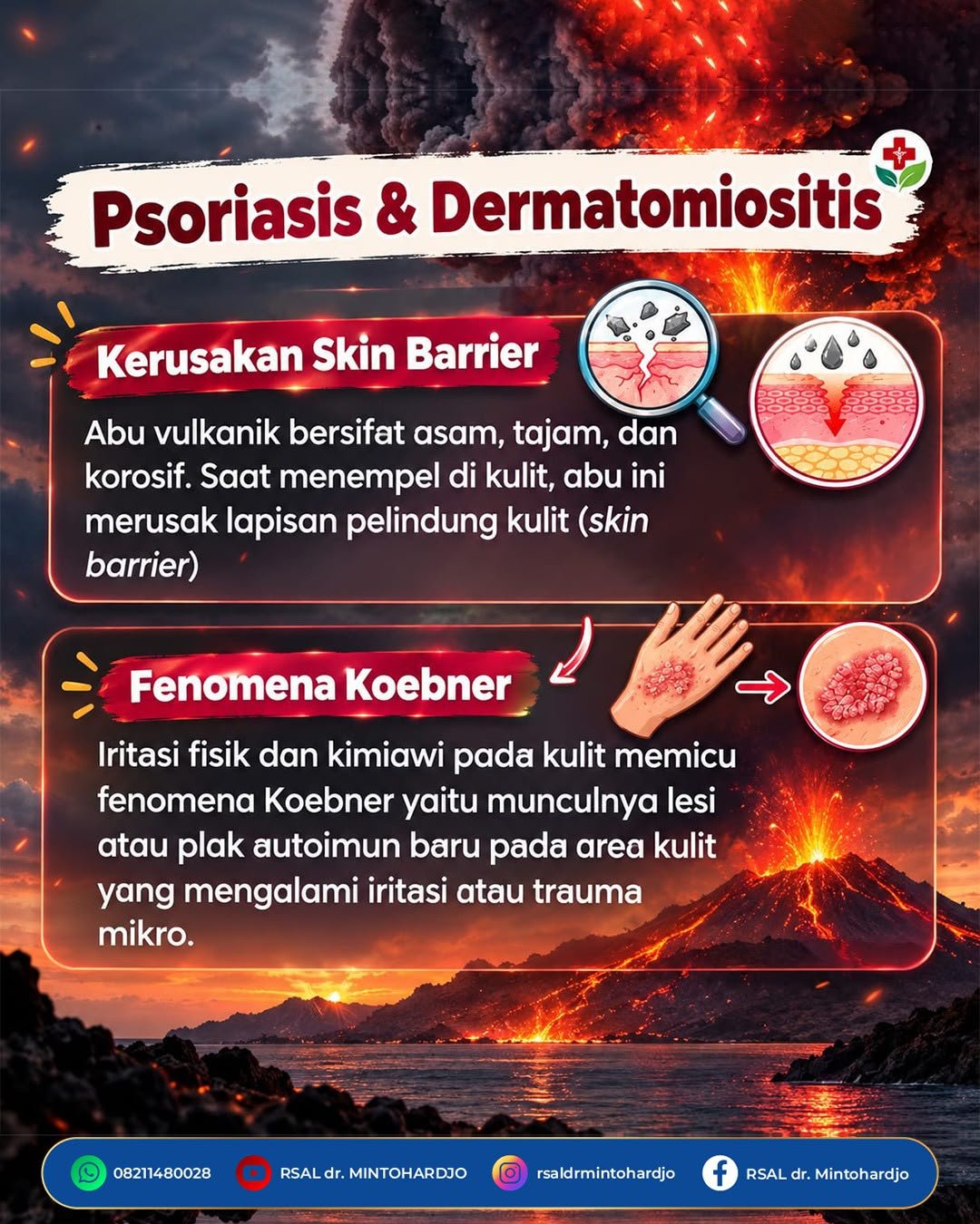 KENALI PENYAKIT DAMPAK ERUPSI KRAKATAU - 2