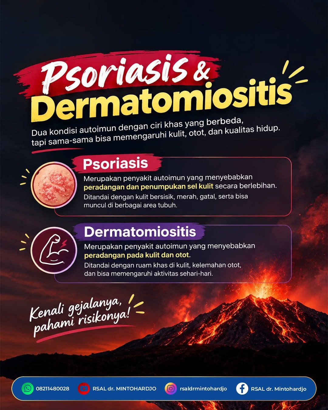 KENALI PENYAKIT DAMPAK ERUPSI KRAKATAU - 3